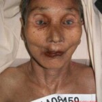 Dead woman in morgue