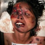 Dead woman in morgue