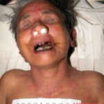 Dead woman in morgue