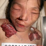 Dead woman in morgue