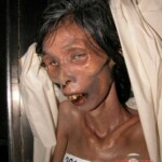 Dead woman in morgue