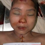 Dead woman in morgue