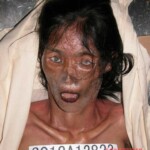 Dead woman in morgue