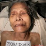 Dead woman in morgue