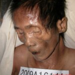 Dead woman in morgue