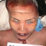 Dead woman in morgue