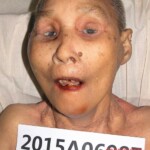 Dead woman in morgue