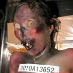 Dead woman in morgue