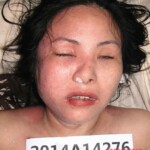 Dead woman in morgue