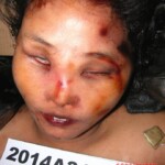 Dead woman in morgue