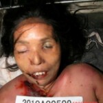 Dead woman in morgue