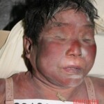 Dead woman in morgue