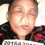 Dead female in morgue