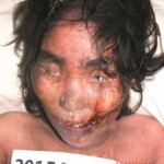 Dead female in morgue