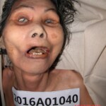 Dead female in morgue