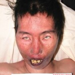 Dead female in morgue