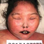 Dead female in morgue