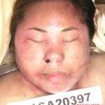 Dead female in morgue