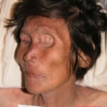 Dead female in morgue