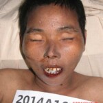 Dead female in morgue