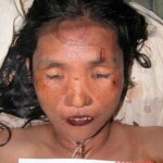 Dead female in morgue