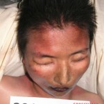 Dead female in morgue