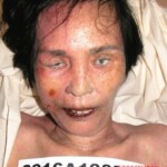 Dead female in morgue