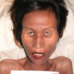 Dead female in morgue