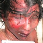 Dead female in morgue