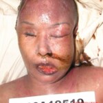 Dead female in morgue