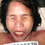 Dead female in morgue