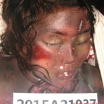 Dead female in morgue