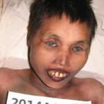 Dead female in morgue