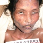 Dead female in morgue