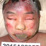 Dead female in morgue