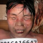 Dead female in morgue