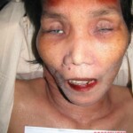 Dead female in morgue