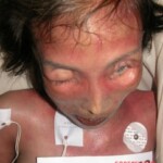 Dead female in morgue