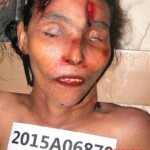 Dead female in morgue