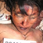 Dead female in morgue