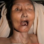 Dead female in morgue