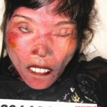 Dead female in morgue