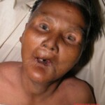 Dead female in morgue