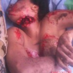 Raped and slashed lady