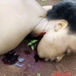 Raped and slashed lady