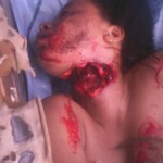 Raped and slashed lady