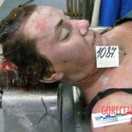 Russian woman in morgue