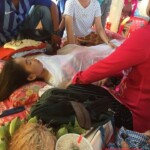 Acute Myeloid Leukemia