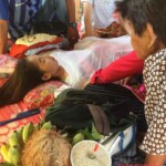 Acute Myeloid Leukemia