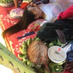 Acute Myeloid Leukemia